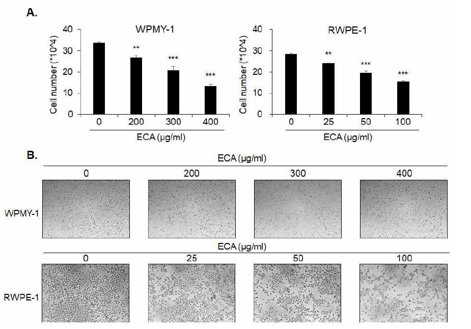 흰말채나무 추출물 처리에 의해 전립선 세포의 증식 억제 A. 전립선 기질세포(WPMY-1)와 상피세포(RWPE-1)의 세포증식 억제 효과 B. 세포 사진 ( * p<0.05, ** p<0.01, *** p<0.001)