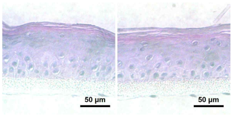 촉매모듈 통과 전, 후 인공피부조직의 H&E 염색 이미지