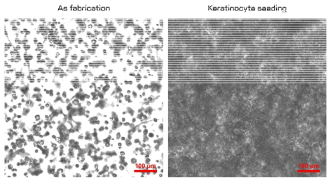 2종 면역세포와 섬유아세포를 담지한 하이드로젤(좌)과 표면에 각질세포를 seeding한 광학이미지(우)