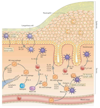 피부 조직 내 면역세포와 신호전달을 위한 싸이토카인 분비 경향