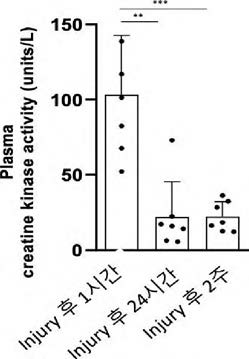 CK활성 즉정 결과