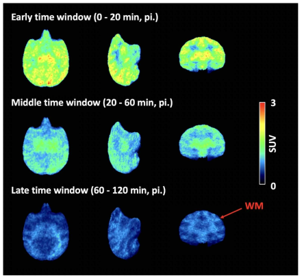 아밀로이드 PET에서 백질/회백질의 분리가 나타나는 시간 영역