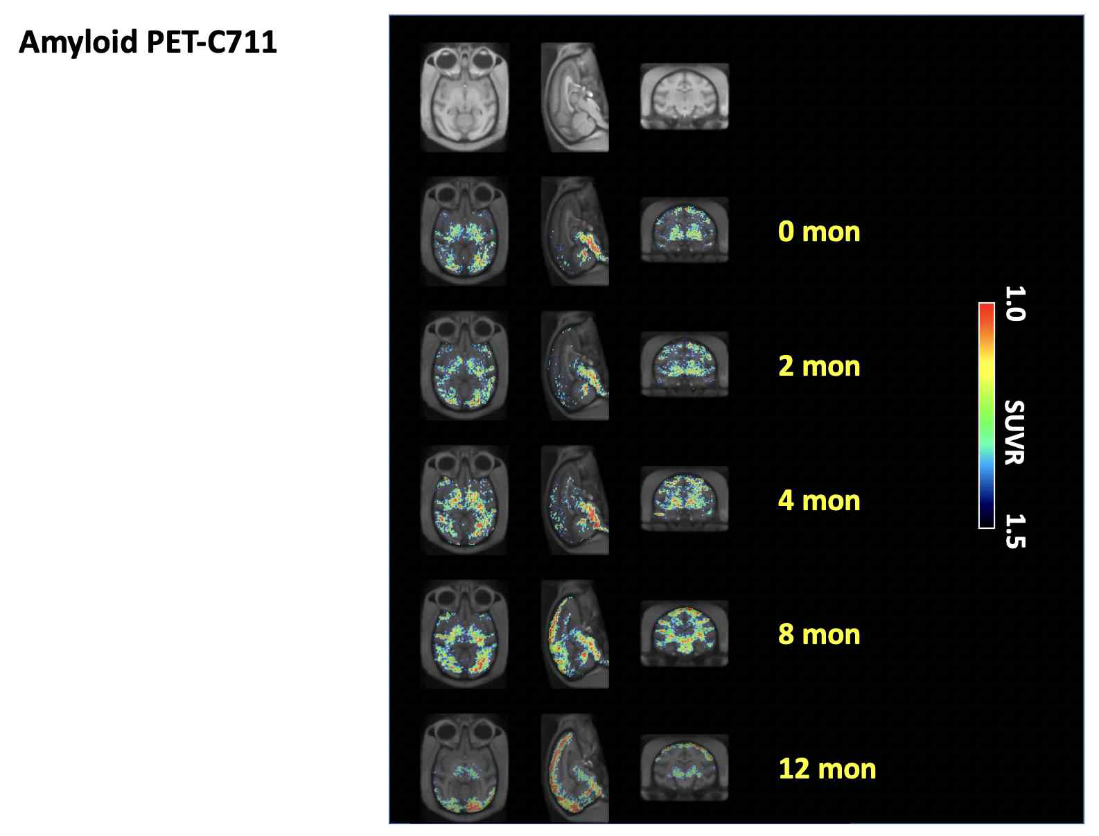 시간 경과에 따른 C711 개체에서의 아밀로이드 PET 뇌 섭취 변화