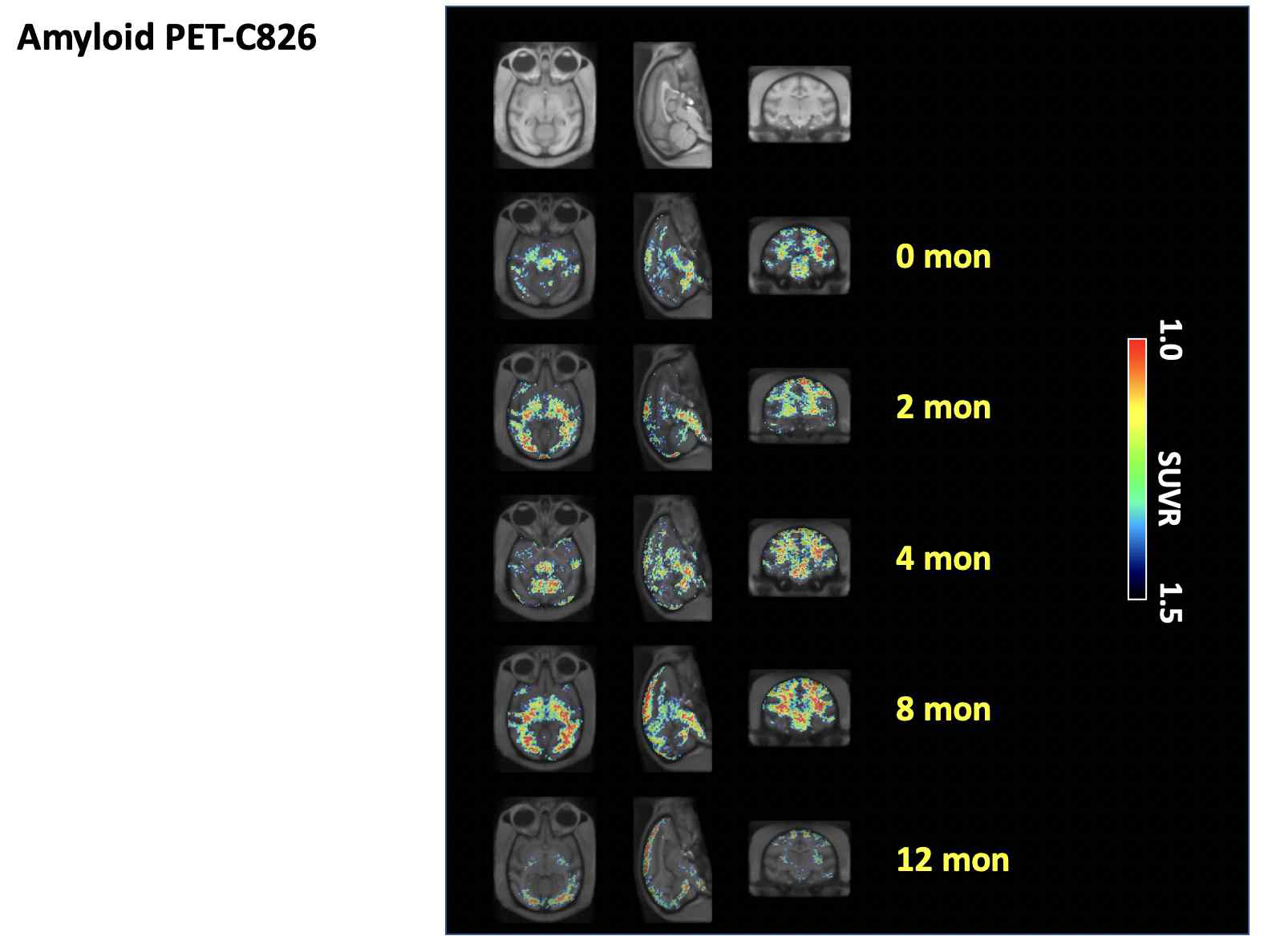 시간 경과에 따른 C826 개체에서의 아밀로이드 PET 뇌 섭취 변화