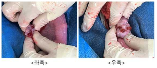 7월 24일 embryo transfer #N8-39, 좌측/우측 난소 상태