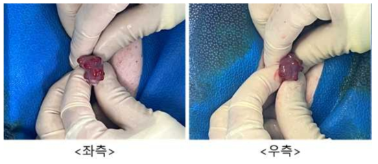 8월 7일 embryo transfer #HF-03, 좌측/우측 난소 상태