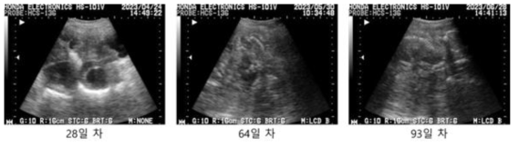 #N9-64 초음파 측정 사진, 이식 후 28일/64일/93일