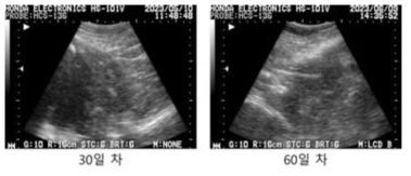 #M8-2 초음파 측정 사진, 이식 후 30일/60일