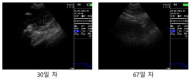 #O6-9 초음파 측정 사진, 이식 후 30일/67일