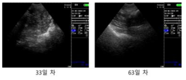 #O4-28 초음파 측정 사진, 이식 후 33일/63일