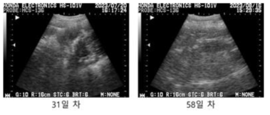 #M7-25 초음파 측정 사진, 이식 후 31일/58일