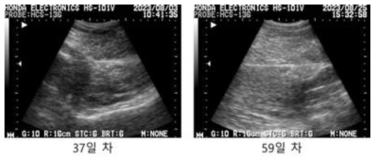 #M8-6 초음파 측정 사진, 이식 후 37일/59일