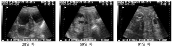 #N8-39 초음파 측정 사진, 이식 후 28일/59일/91일