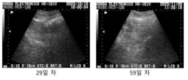 #HK-07 초음파 측정 사진, 이식 후 29일/59일