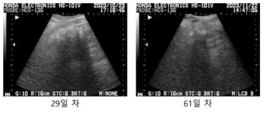 #HK-22 초음파 측정 사진, 이식 후 29일/61일
