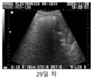 #FE-09 초음파 측정 사진, 이식 후 29일