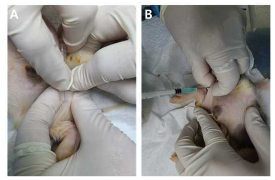 A),B) 23SCID-1-1 개체 고환 내 hiPSCs 세포이식