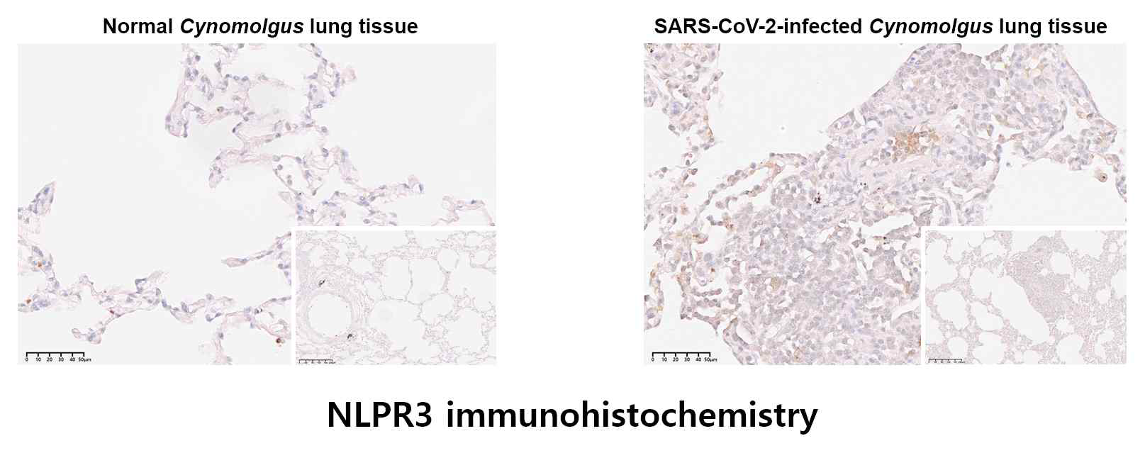 SARS-Cov-2 감염 영장류 폐 조직에서 NLPR3 immunohistochemistry