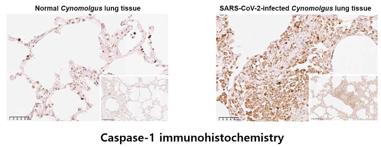 SARS-Cov-2 감염 영장류 폐 조직에서 caspase-1 immunohistochemistry