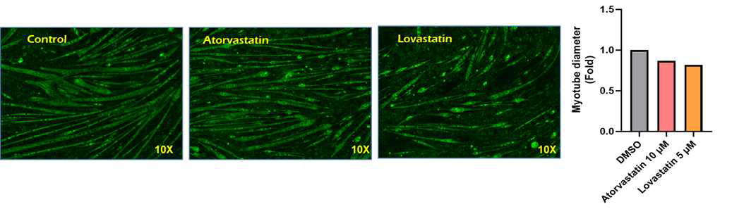 근육세포 모델에서 스타틴에의 한 분화 저항 탐색_MyHC 형광염색