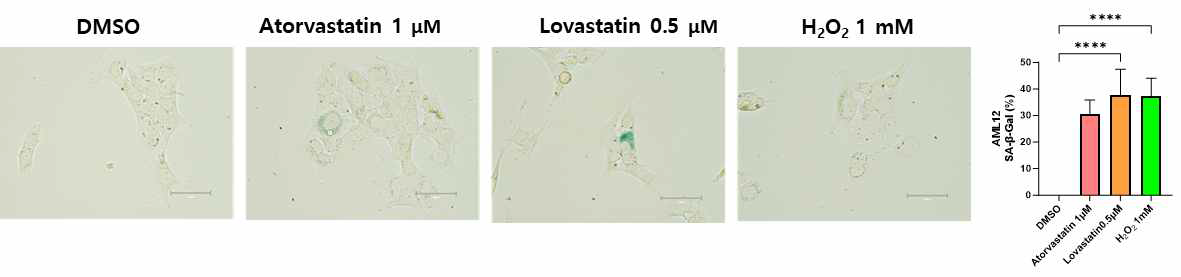 스타틴에 의한 세포노화 및 β-gal 염색