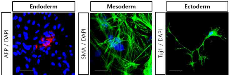 Rh-, O형 iPSC의 pluripotency를 확인하기 위한 3 germ layer 분화 후 ICC로 분석