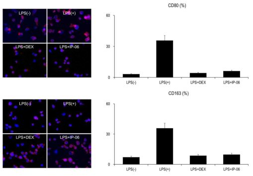원료세포 및 IP 세포 분비 측인자에 의한 M1 대식세포에서 M2 대식세포로의 전환 유도 효력