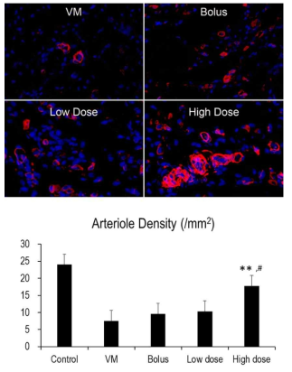 시험용 의약품의 경색하지 근육에서 소동맥 생성 효력 **, VM 대비 p < 0.01; #, Bolus 및 Low dose 대비 p < 0.05