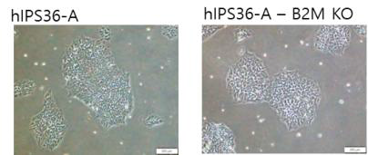 iPSC 36A 형태학적 변화 확인