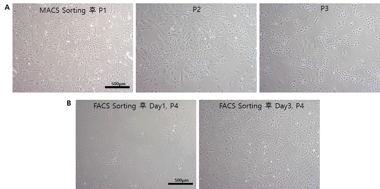 (A) CD144+ MACS sorting 후 passage 별 36A iEC 형태 (B) CD144+ CD31+ FACS resorting 후 P4, 36A iEC 형태