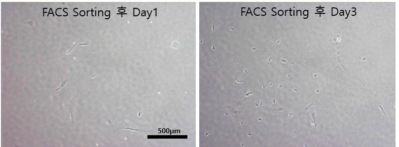 CD144+ CD31+ FACS sorting 후 P1, 36A iEC 형태