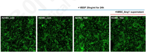 ZO-1 염색으로 cell-cell contact에서 Ang1의 영향 평가