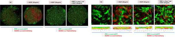 RPE세포와 HUVEC 세포가 혼합된 대표 및 z-stack 공초점 이미지