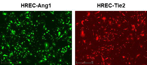 HREC세포에 Ang1 유전자와 Tie2 유전자 전달 검증
