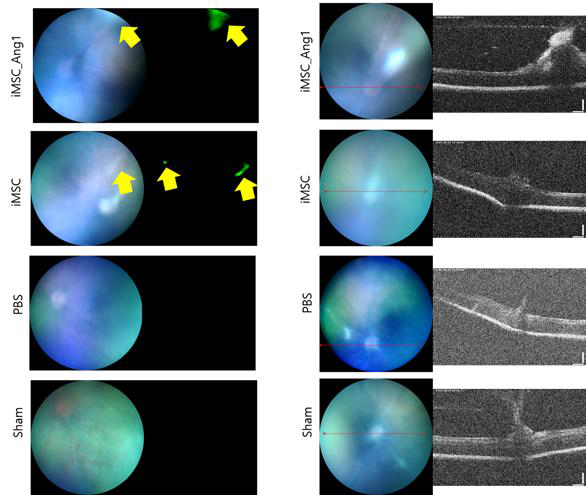 Ang1 iMSC, iMSC, PBS 및 Sham 대조군의 안저사진 및 OCT 이미지. Ang1 iMSC 및 iMSC는 gfp 태깅되어있으므로 안저촬영시 GFP 필터를 사용하여 촬영하였음. Ang1 iMSC와 iMSC 사진에서는 초록색으로 세포가 관찰됨