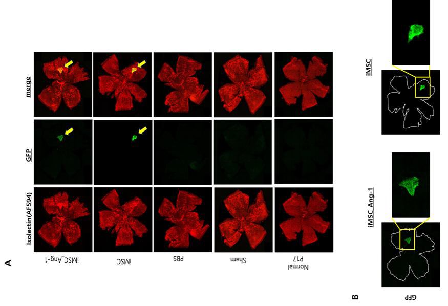 생후 17일차의 정상 모델과 실험군 별 flatmount 촬영이미지. Ang1 iMSC 및 iMSC는 초록색으로 관찰됨