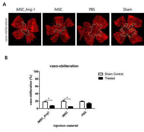 Vaso-obliteration(VO) 분석결과와 그룹별 flatmount 분석이미지(Ang1 iMSC, iMSC, PBS, Sham). (A) isolectin iB4 염색된 망막 flatmount 조직 현미경 사진. (B) 각 그룹별 VO 평균을 나타내는 막대 차트. iMSC 그룹은 Ang1 iMSC 그룹보다 VO가 더 많이 감소하였다