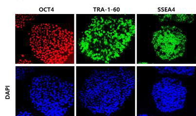 iPSC 36A 전능성 marker 확인