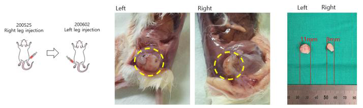 hiPSC 36A teratoma assay