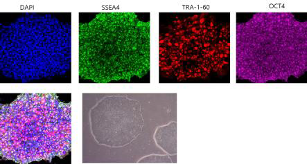 iPSC H4 전능성 marker 확인
