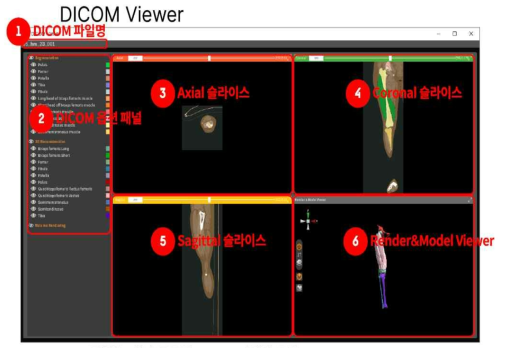 DICOM 파일 뷰어 및 3D 모델링 뷰어 기능