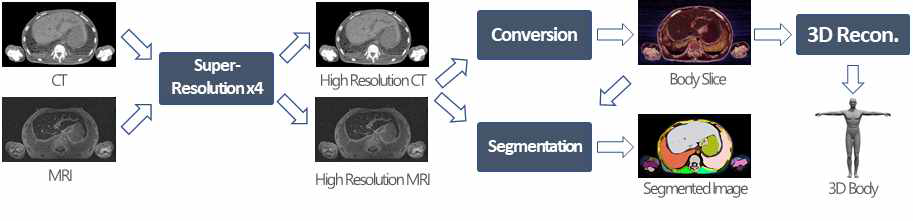 인체 의료 영상 데이터 기반 3D 모델 제작을 위한 AI 기술 개발의 전체적인 연구 절차