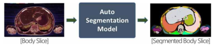 의료영상 기반 자동 구획화 모델 개념도