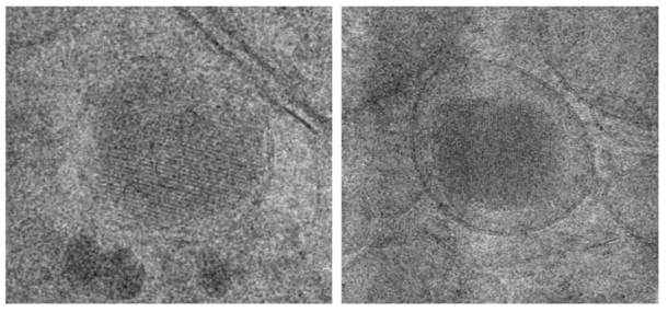 Vesicle 내부의 단백질 결정