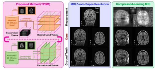 3차원 의료영상 볼륨 개선 foundation 모델 TPDM의 모식도 및 볼륨 개선 결과 예시