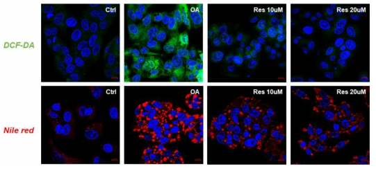 In vitro 지방간세포 모델 설립 검증. 지방간세포에 RSV 처리 후 세포 내 지방산 및 활성산소 confocal 분석