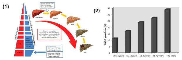 (1) 비알코올성 지방간 심화 과정 및 연령별 발생 분포. (2) 연령별 비알코올성 지방간 유병률. [4,9]
