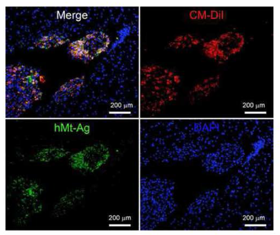 Immunofluorescent staining with ant i -human- spec i f i c mitochondria anti gen (hMt-Ag) in spinal cord injected with CM-Dil cells