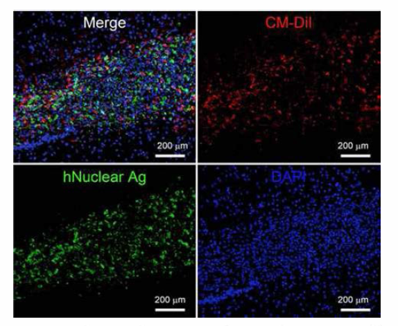 Immunofluorescent staining with ant i -human- spec i f i c nuclear anti gen (hNuclear Ag) in spinal cord injected with CM-Dil cells