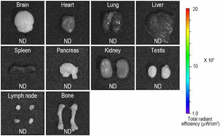 Representative ex vivo fluorescence optic images of various organs in male Balb/c nu/nu mouse injected with spheroids composed by CM-Dil labeled nerve derived stem cells at 1 day of injection